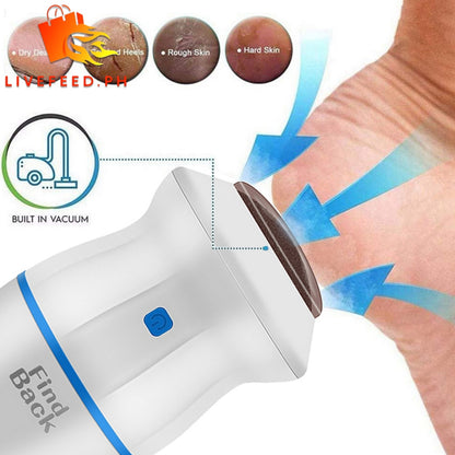 Electric USB Foot Grinder – Portable Callus Remover and Foot Care Device