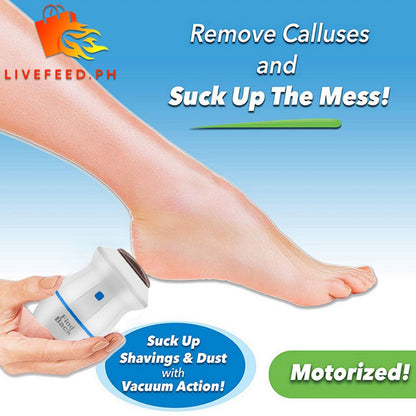 Electric USB Foot Grinder – Portable Callus Remover and Foot Care Device